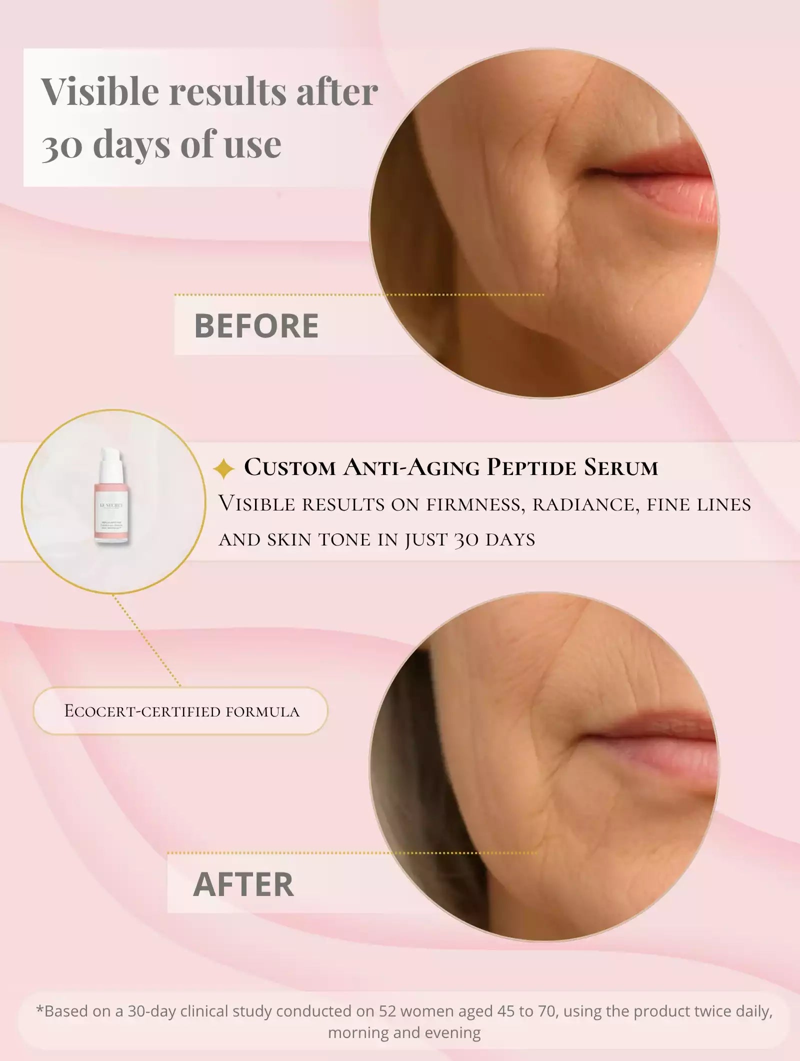 Custom Anti-Aging Serum – Peptides & Botox Effect